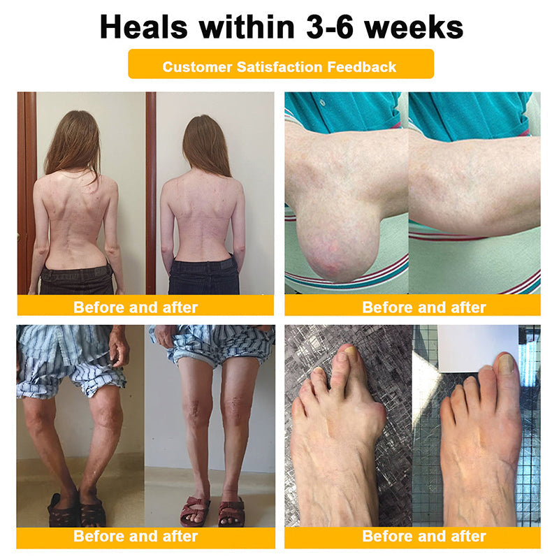 【Last Day Promotion 80% OFF🔥】FDA Official: LBMLBM™ BeeVenom Joint Relief Patch – Arthritis Pain Relief, Anti-Inflammation & Mobility Support(Zero Pain | 24/7 Comfort | Natural Healing)🔥🎁
