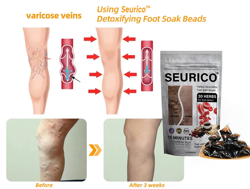 Seuricoโข Herbal VenoDetox Foot Bath Beads (๐๐๐๐ ๐๐๐ซ๐ญ๐ข๐๐ข๐๐๐ญ๐ข๐จ๐ง๏ผ๐๐๐บ๐ฝ๐ต๐ฎ๐๐ถ๐ฐ ๐๐๐๐ผ๐ฐ๐ถ๐ฎ๐๐ถ๐ผ๐ป ๐ผ๐ณ ๐๐บ๐ฒ๐ฟ๐ถ๐ฐ๐ฎ)