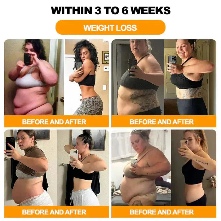 【Last Day Promotion 80% OFF🔥】FDA Official: LBMLBM™ BeeMelittin Slimming Patch – Fat Burning, Cellulite Reduction & Body Shaping(Zero Pain, 24/7 Release | Lose 20lbs FAST | 90% Sugar Drop | )🔥🎁