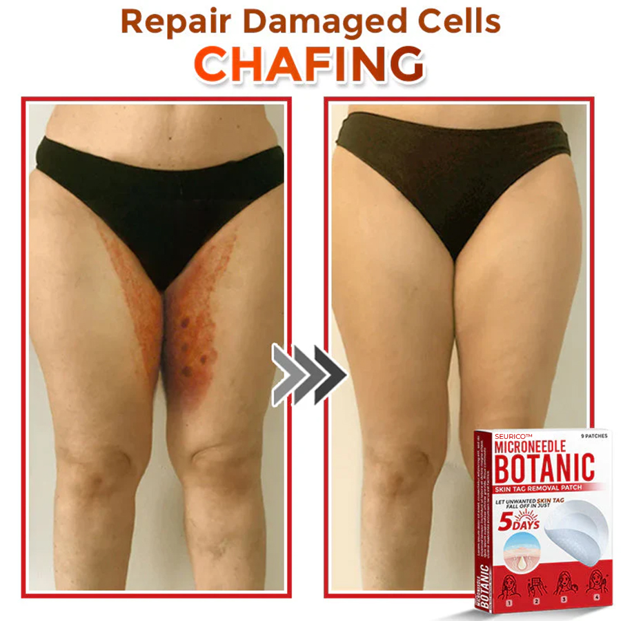 Seurico™ MicroNeedle Botanic Skin Tag Removal Patch