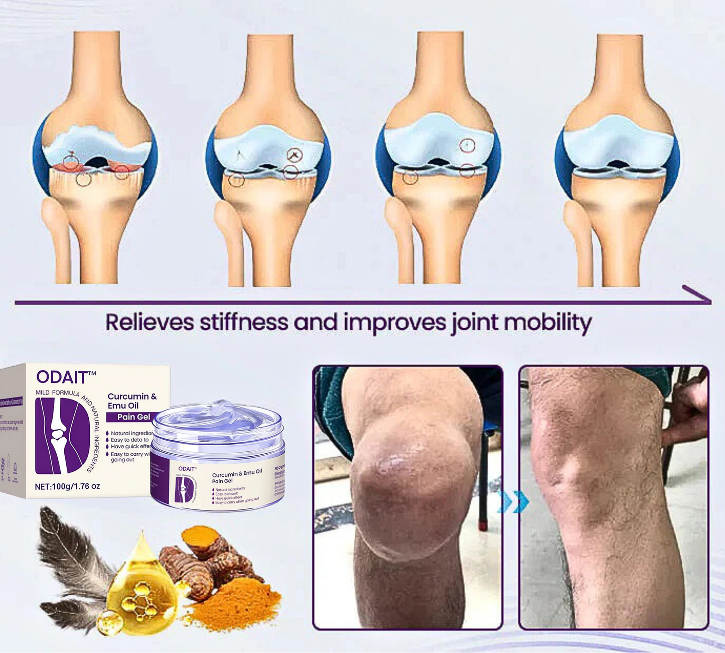 ODAIT⢠ Curcumin & Emu Oil Pain Gel-š„Backed by Us Osteopathic Experts