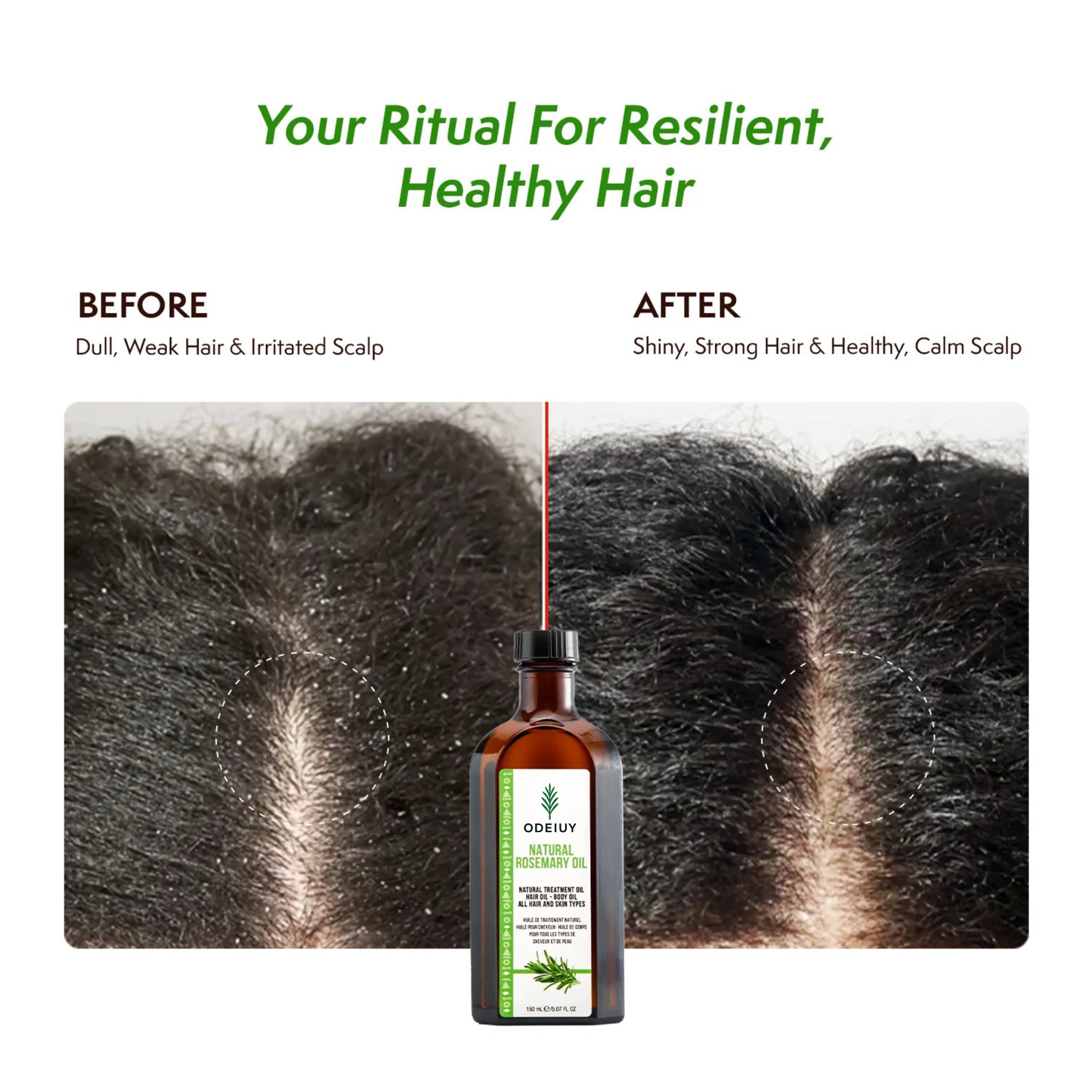 ⏰LIMITED SALE 50% OFF!!🎁ODEIUY Rosemary Hair Nourishment Oil🌿✨
