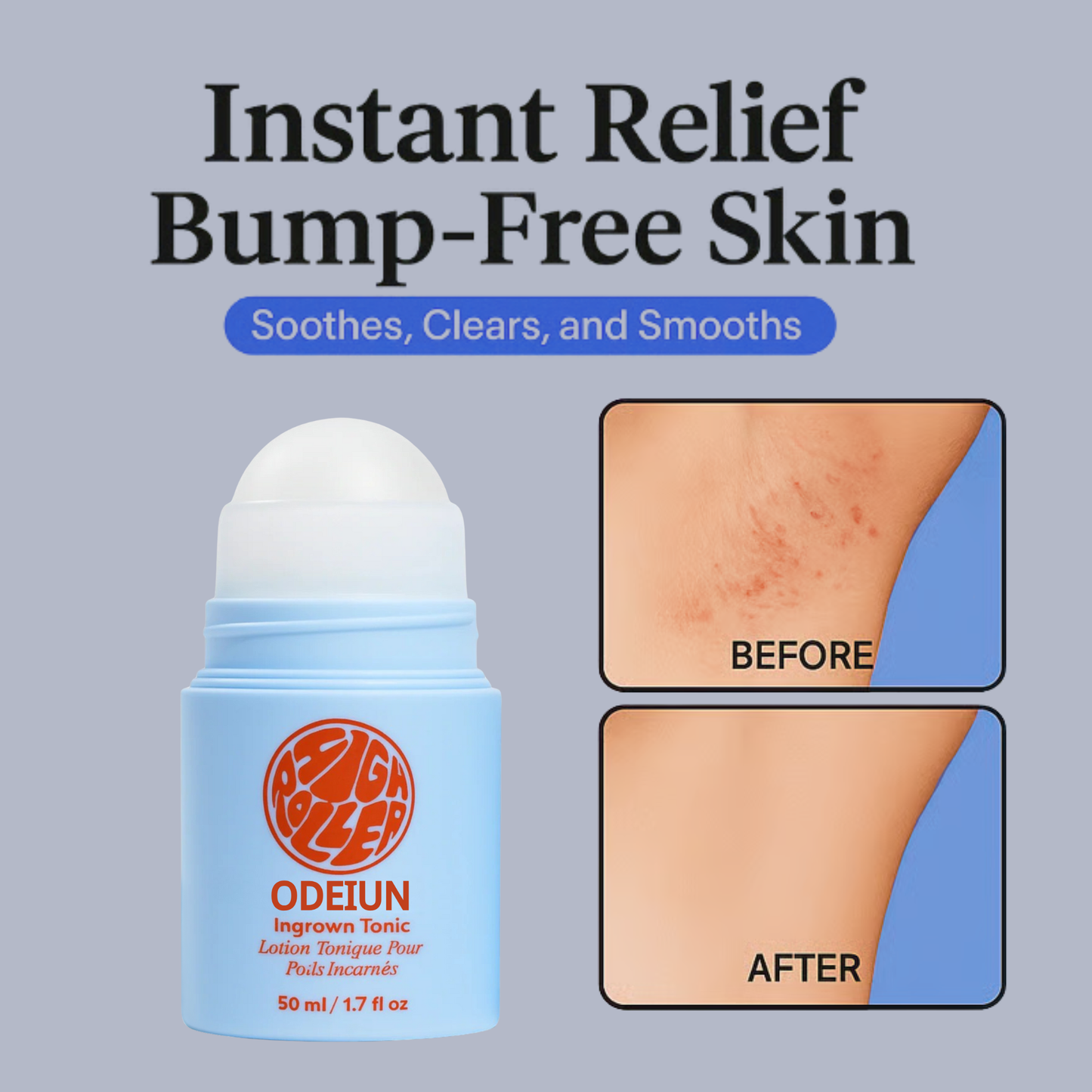 High Roller Ingrown Tonic - Serum for Eliminating Ingrown Hairs and Razor Bumps