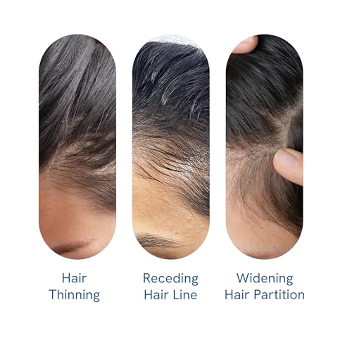 Rediscover Your Confidence: The Secret to Thicker, Fuller Hair is Here