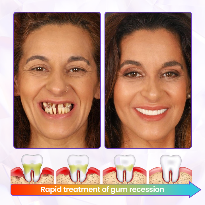 ODAIT® BeeRenew Advanced Gum Healing Toothpaste