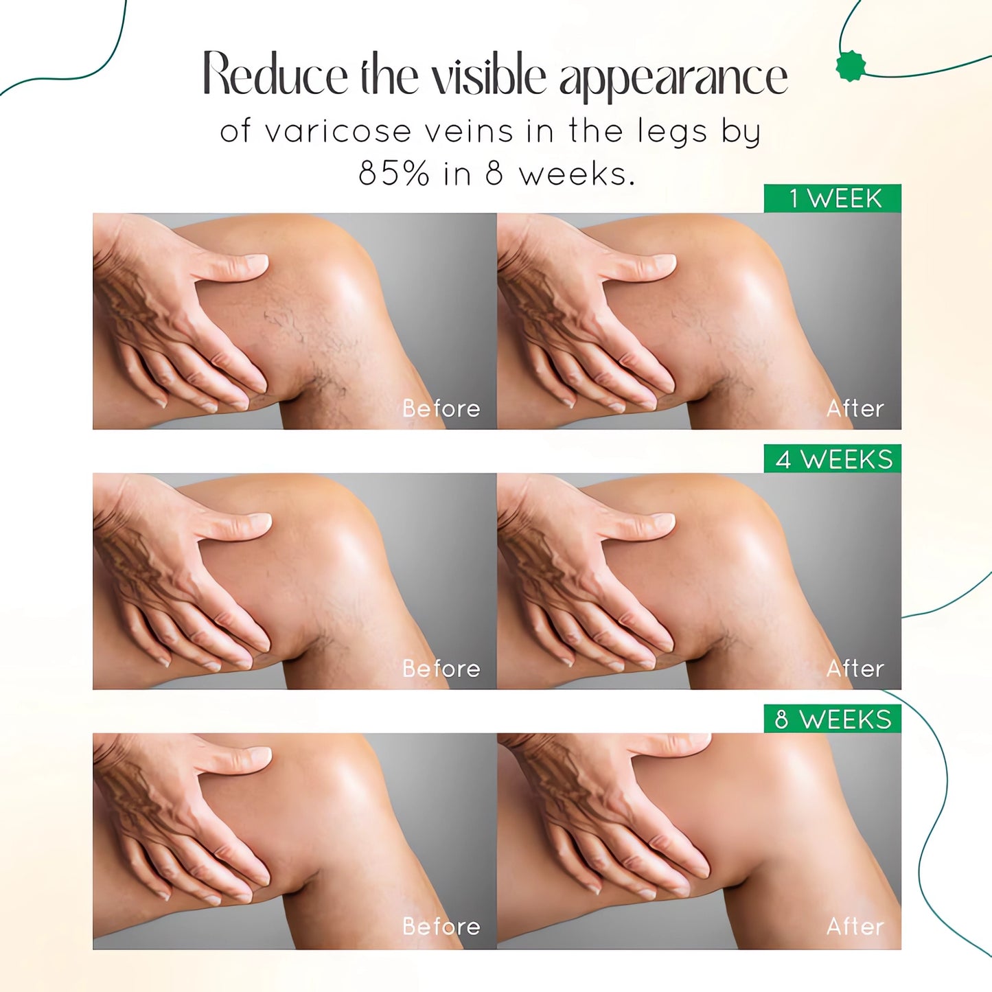 JEREMYTIS™ Vein Therapy Cream