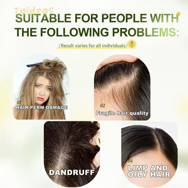 Tgideas Anti-Hair Fall Hair Loss Treatment Shampoo