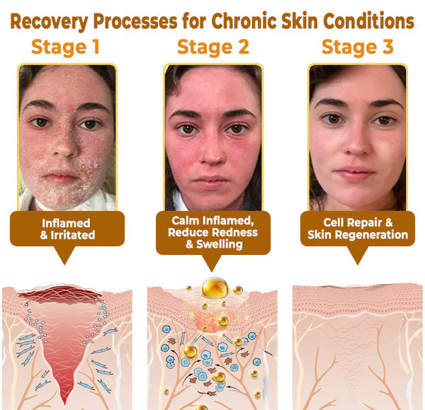 💥Limited-time discount: 80% off💥"Forbidden" Natural Breakthrough! Erases Years of Skin Damage – Beats Psoriasis, Wrinkles & Chronic Skin Woes Fast!