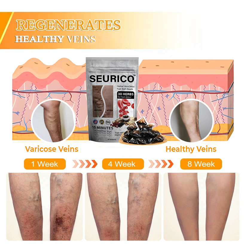Seuricoโข Herbal VenoDetox Foot Bath Beads (๐๐๐๐ ๐๐๐ซ๐ญ๐ข๐๐ข๐๐๐ญ๐ข๐จ๐ง๏ผ๐๐๐บ๐ฝ๐ต๐ฎ๐๐ถ๐ฐ ๐๐๐๐ผ๐ฐ๐ถ๐ฎ๐๐ถ๐ผ๐ป ๐ผ๐ณ ๐๐บ๐ฒ๐ฟ๐ถ๐ฐ๐ฎ)