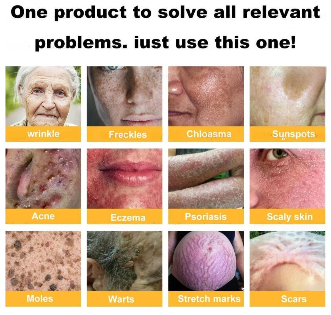 💥Limited-time discount: 80% off💥"Forbidden" Natural Breakthrough! Erases Years of Skin Damage – Beats Psoriasis, Wrinkles & Chronic Skin Woes Fast!