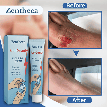 Zentheca Footguard+ |FINALLY! A Better Way To Treat Wounds, Ulcers or Discoloration of the Leg, Ankle or Foot!