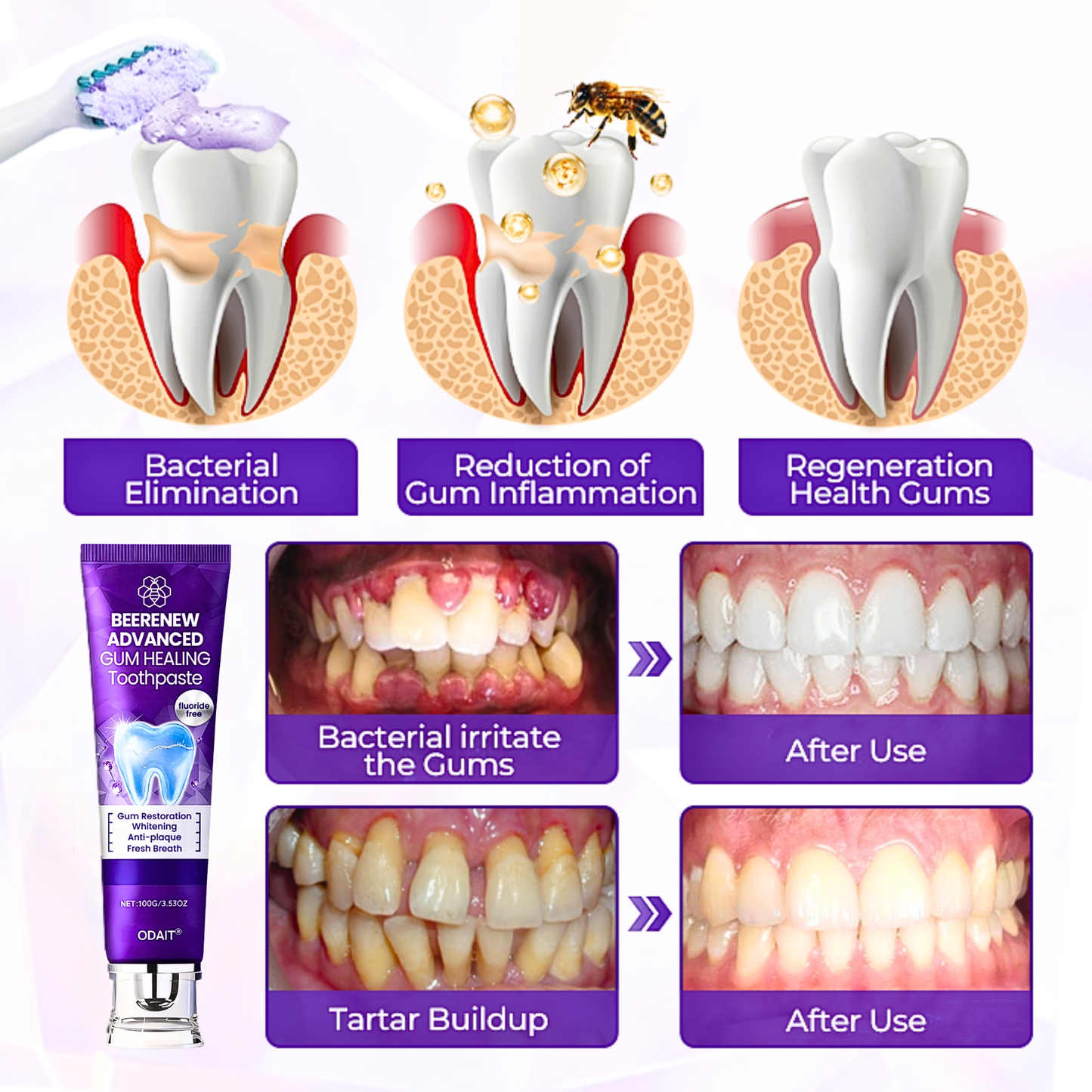 ODAIT® BeeRenew Advanced Gum Healing Toothpaste