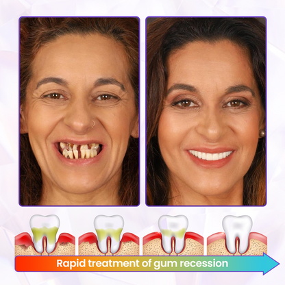 ODAIT® BeeRenew Advanced Gum Healing Toothpaste