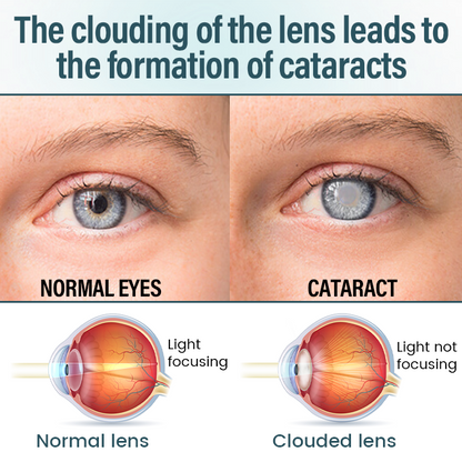 𝗧𝗶𝗺𝗹𝗹𝗸® OptiFusion Nano Eye Drops Serum - Nano-Technology Eye Drops for Root Cause Vision Repair