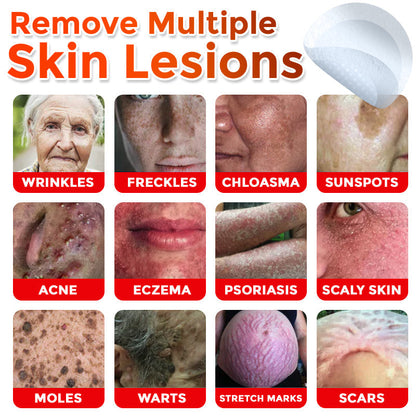 Seurico™ MicroNeedle Botanic Skin Tag Removal Patch