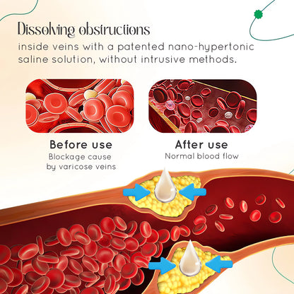 JEREMYTIS™ Vein Therapy Cream