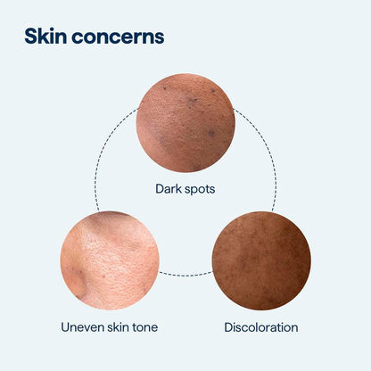 NEGUSY for Dark Spots - All-in-One Nightly Serum for Fading Dark Spots & Evening Skin Tone with Retinol, Kojic Acid & Tranexamic Acid