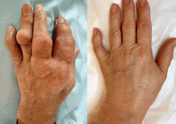 Zakdavi™Repair Cartilage Glucosamine Joint Gel