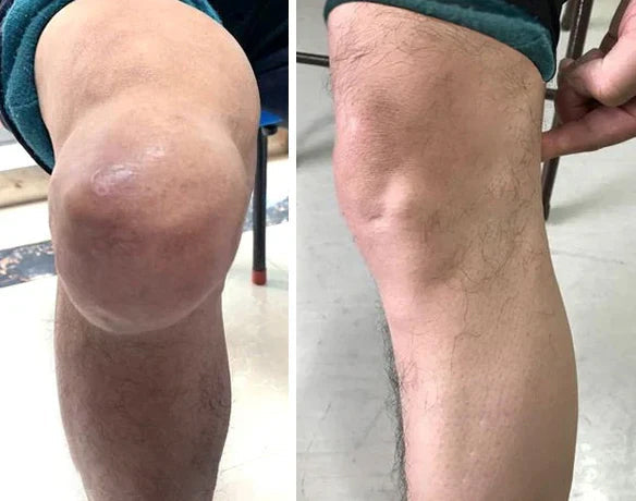 Zakdavi™Repair Cartilage Glucosamine Joint Gel